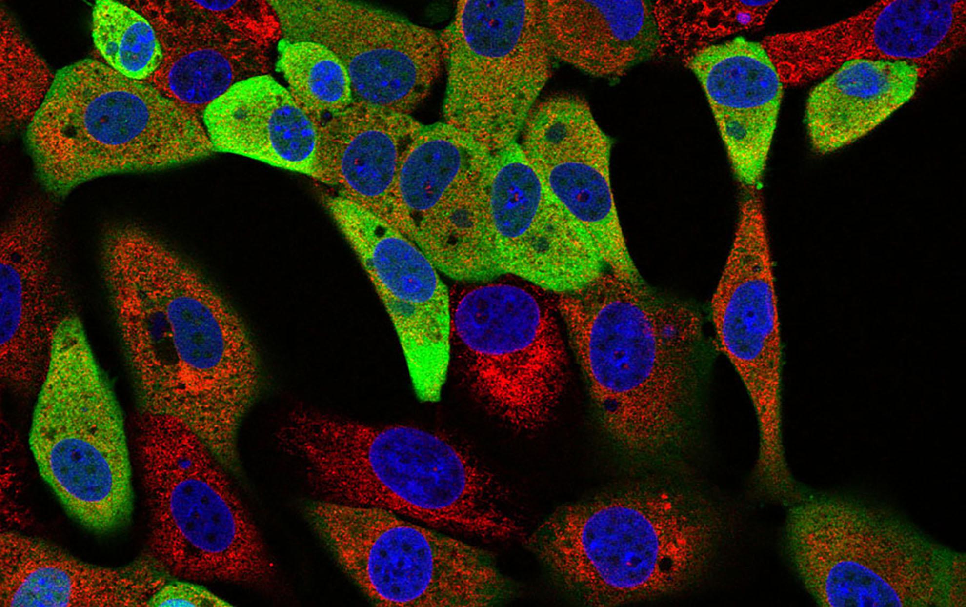 Microscopy image of ASF cells