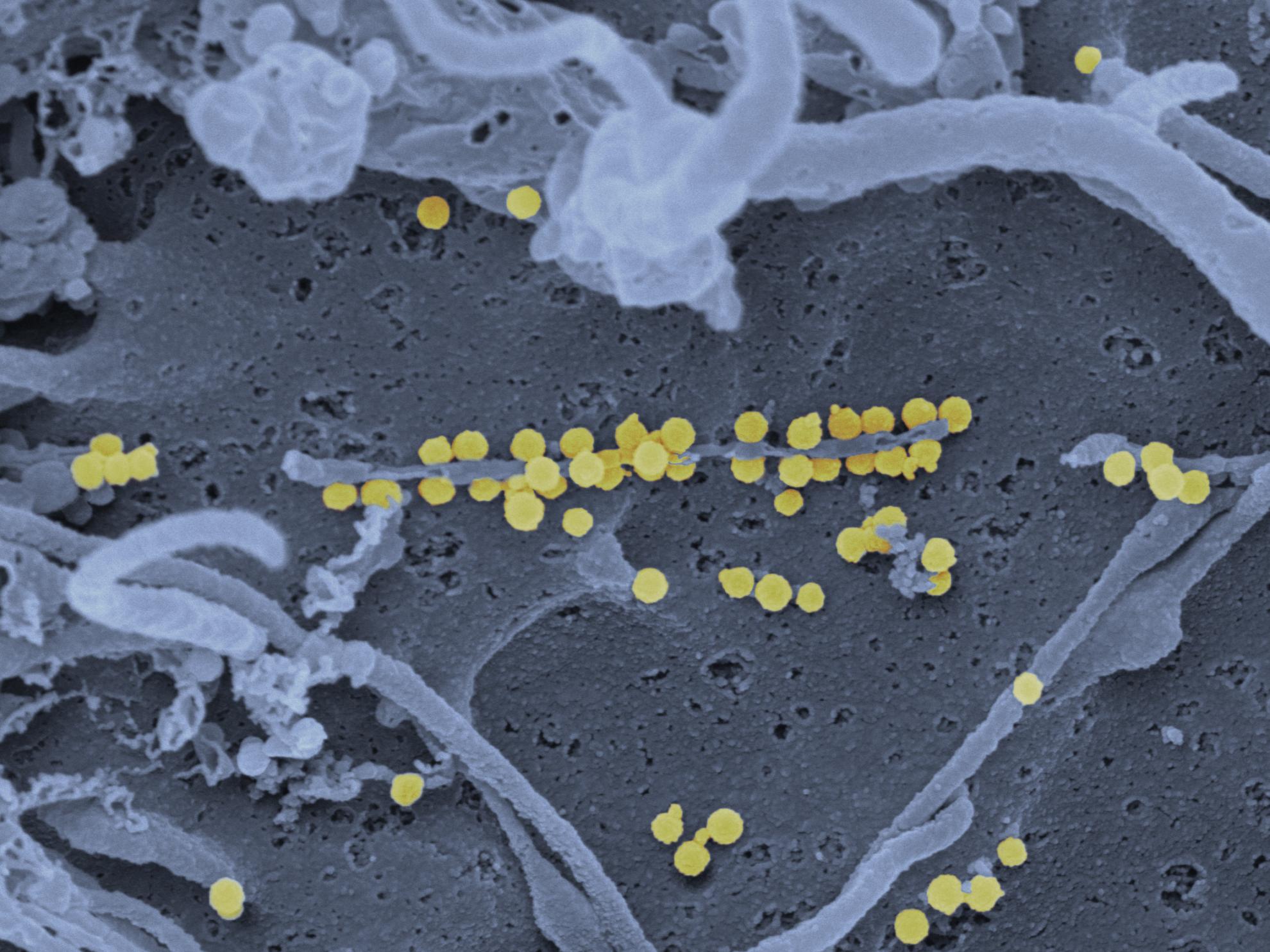 Scanning electron micrograph of Crimean-Congo hemorrhagic fever (CCHF) viral particles (yellow) budding from the surface of cultured epithelial cells from a patient. Credit: NIAID - Creative Commons Attribution 2.0 Generic 