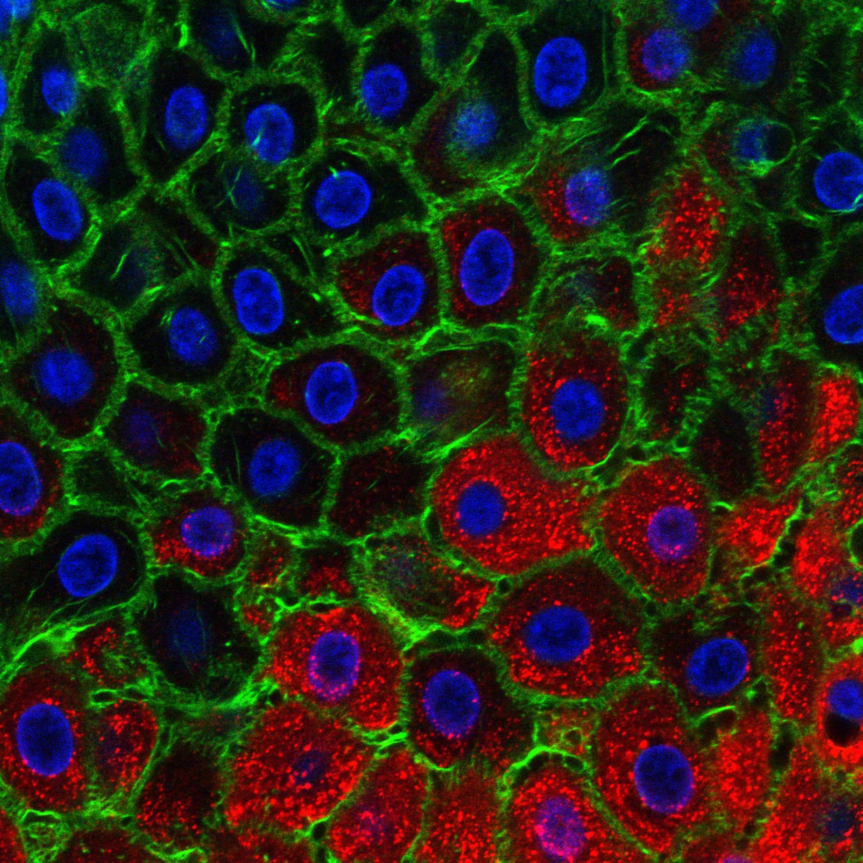 Foot-and-mouth disease