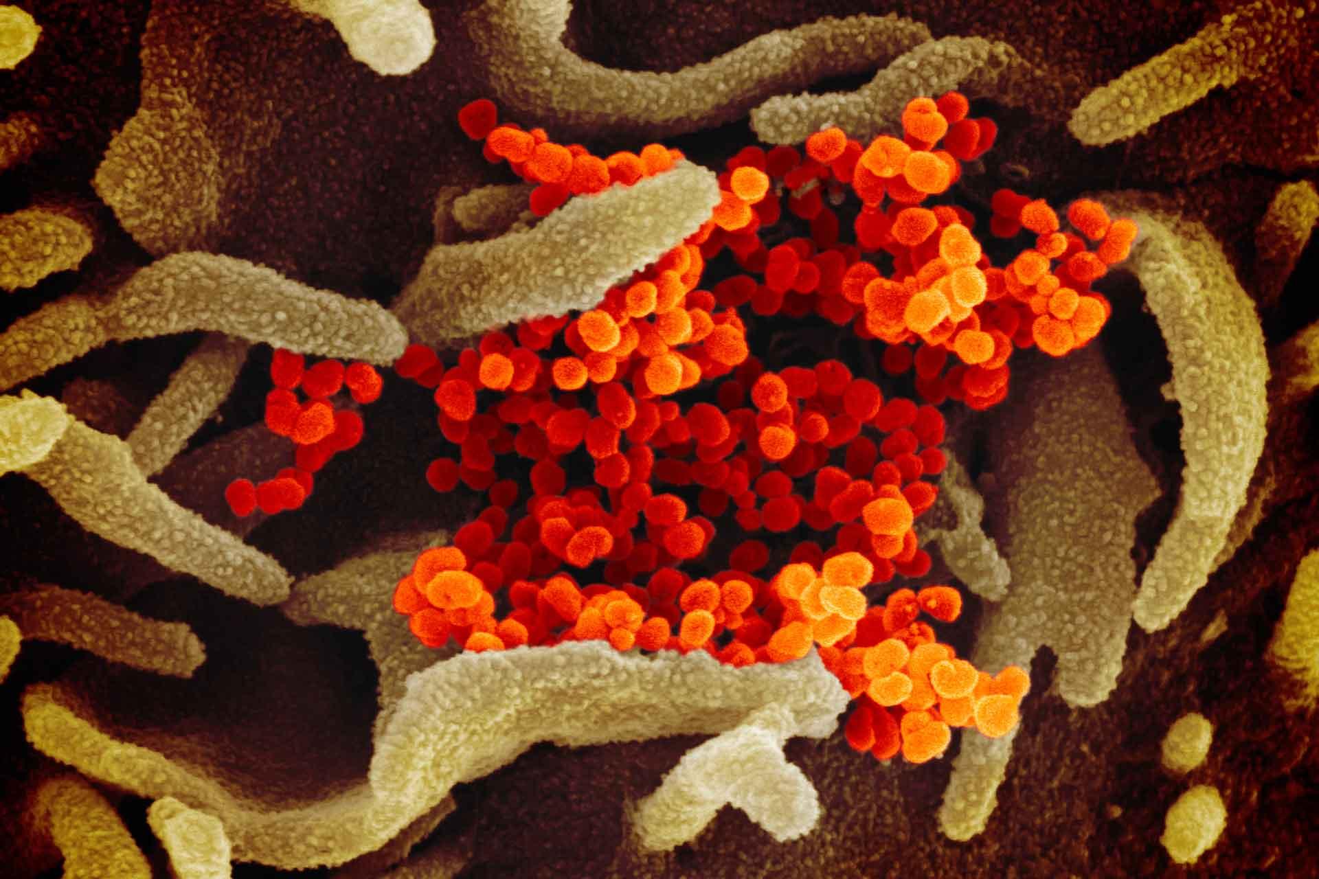 This scanning electron microscope image shows SARS-CoV-2 (yellow)—also known as 2019-nCoV, the virus that causes COVID-19—isolated from a patient in the U.S., emerging from the surface of cells (pink) cultured in the lab. 