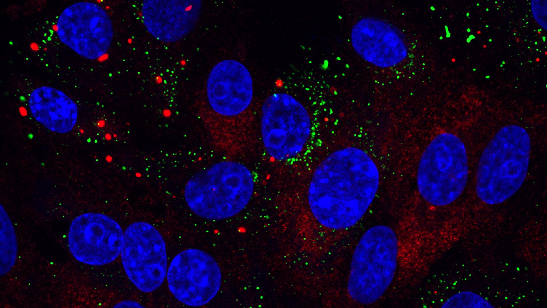 Infectious bronchitis virus (IBV)