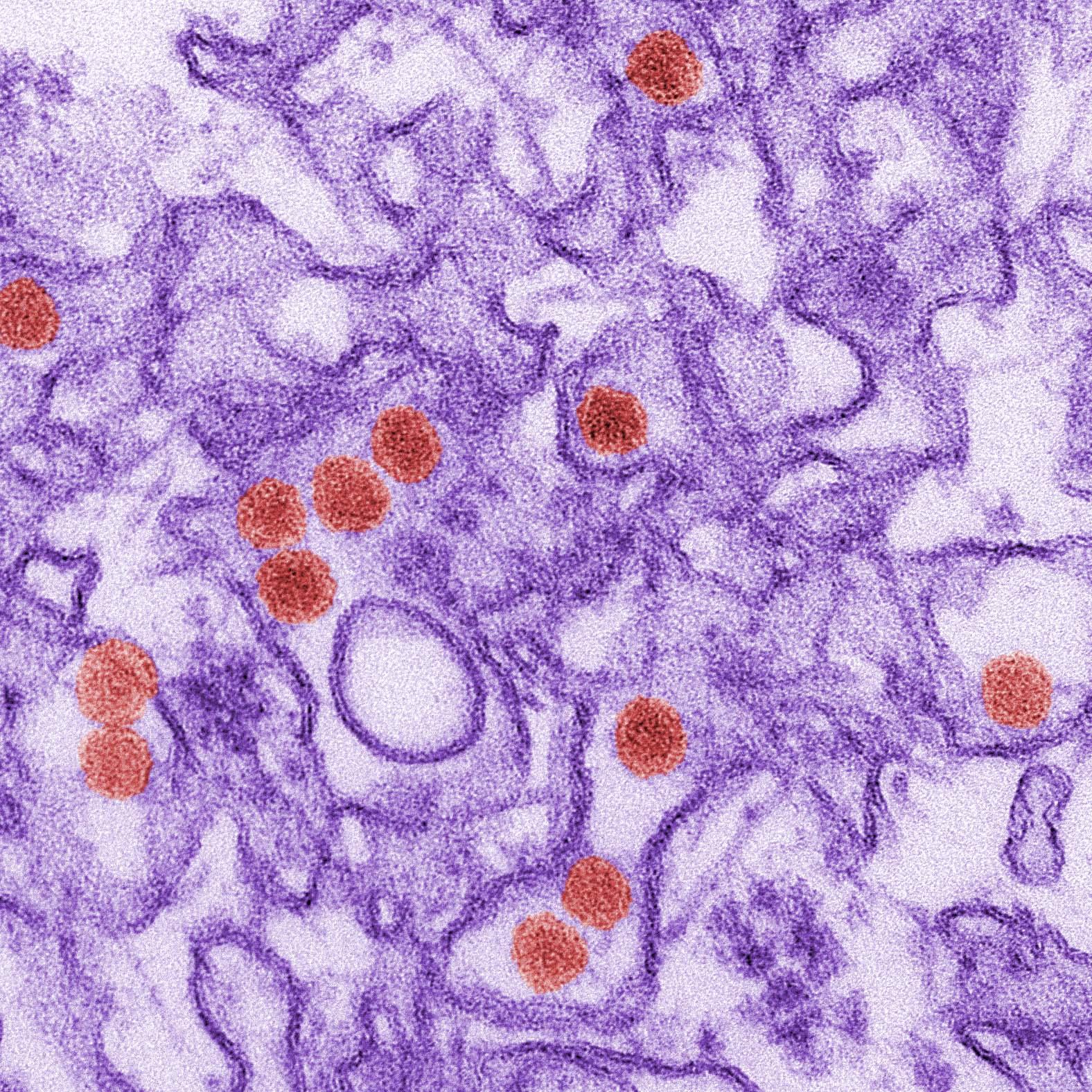 A digitally colorized transmission electron microscopic (TEM) image of Zika virus. Virus particles are coloured red, the rest of the cell image is purple.